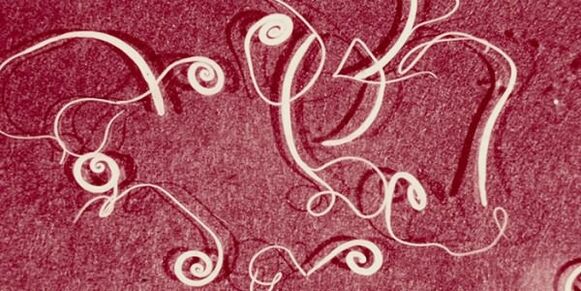 Адамдардын паразиттеринин сүрөтү