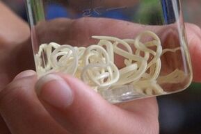 Адамдын денесиндеги паразиттер